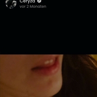 Ceryza Çıplak