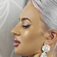 Florina Çıplak