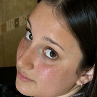 keshaortegafree Çıplak