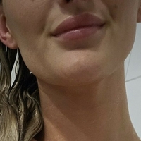 Marie Müller Çıplak