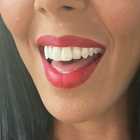 rachelstarrxxx Çıplak