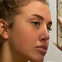 Rochelllle Çıplak