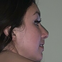 Ronisofine Çıplak