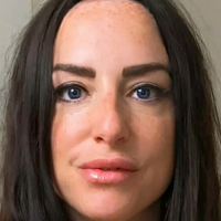 scarred4life3 Çıplak
